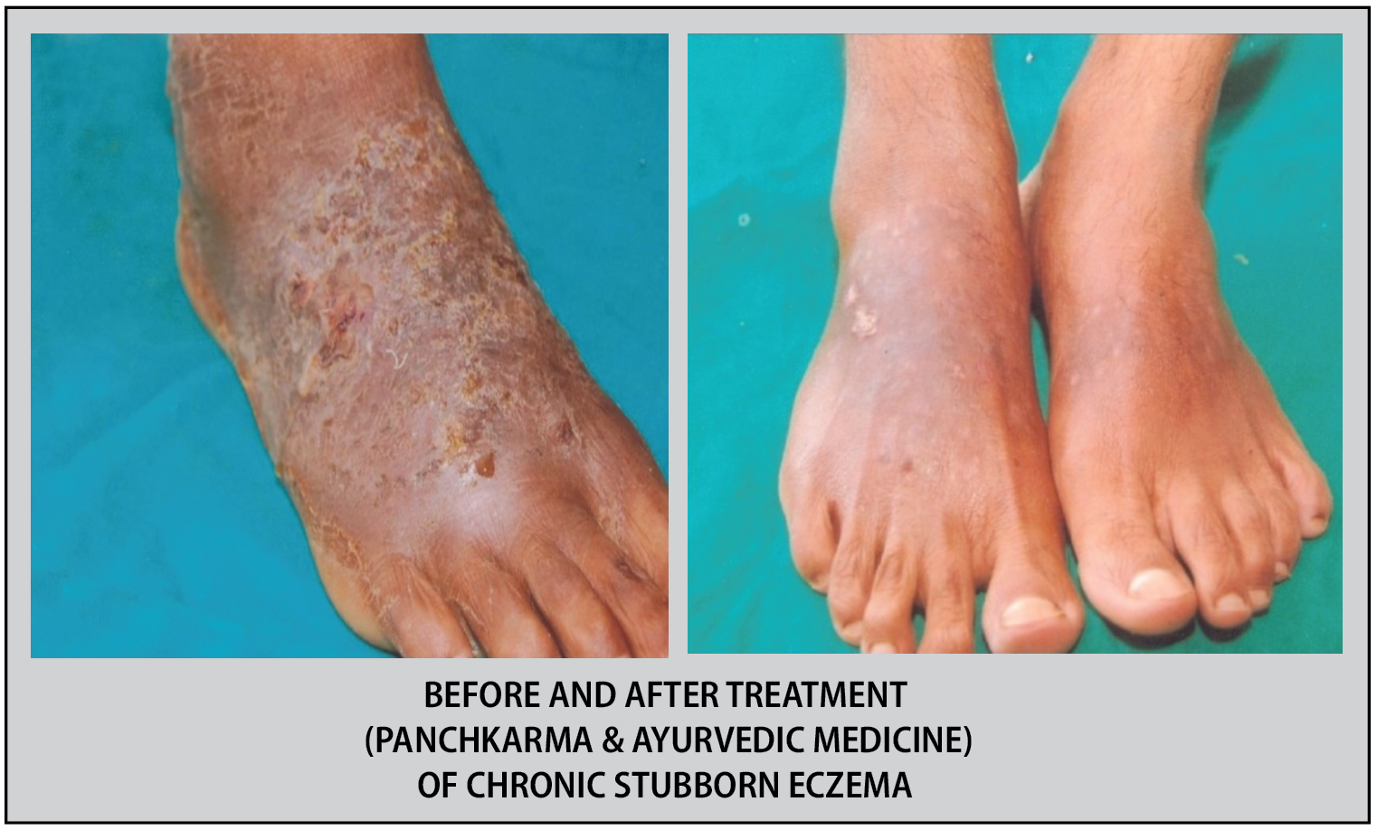 Treatment Image