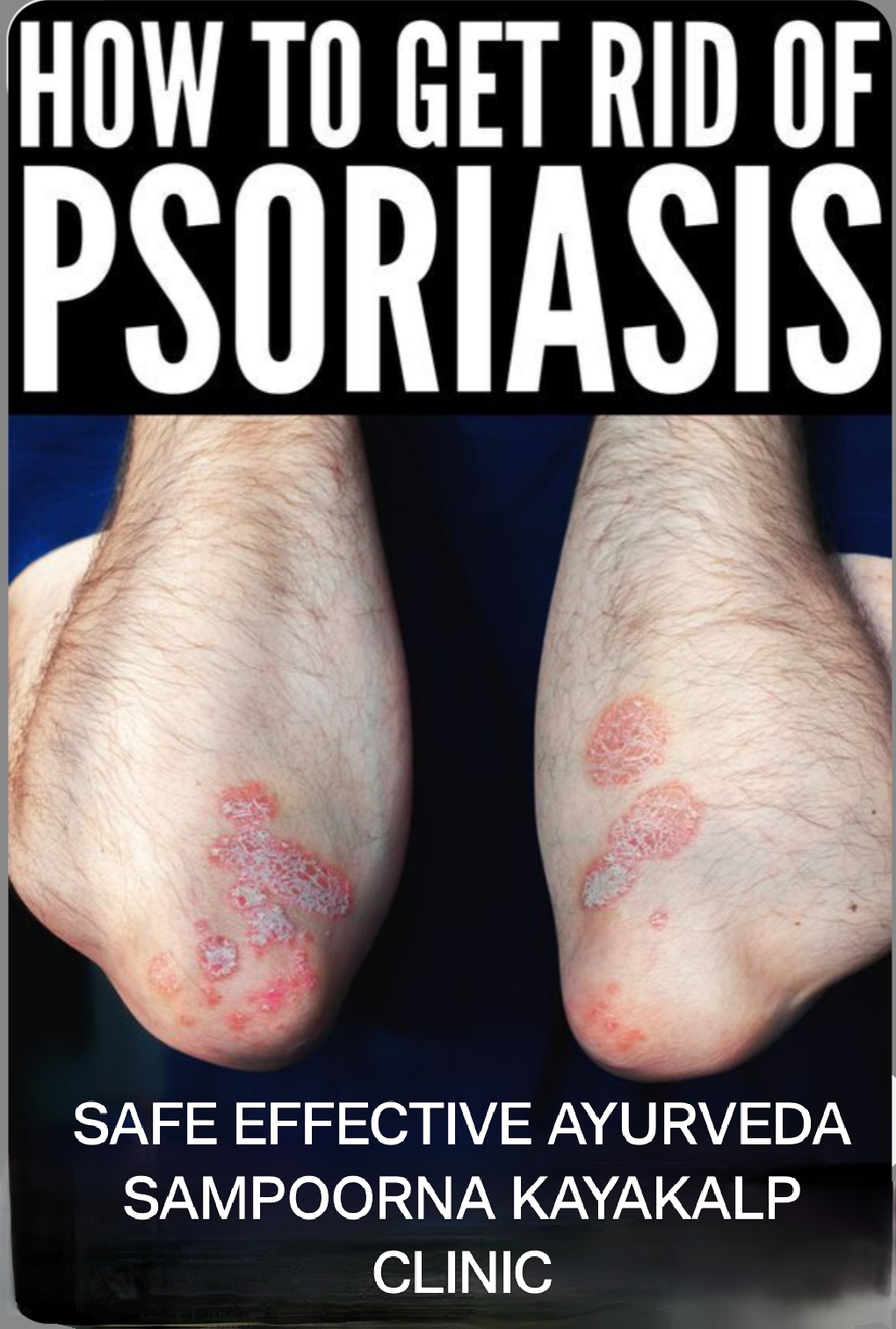 Treatment Image